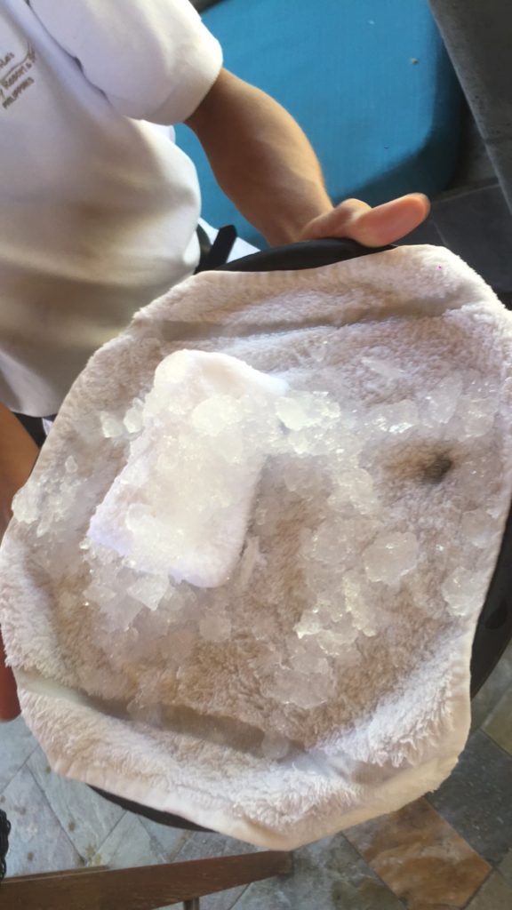 Iced towel in Manila, Philippines. A week at the Shangri-La Resort, Boracay