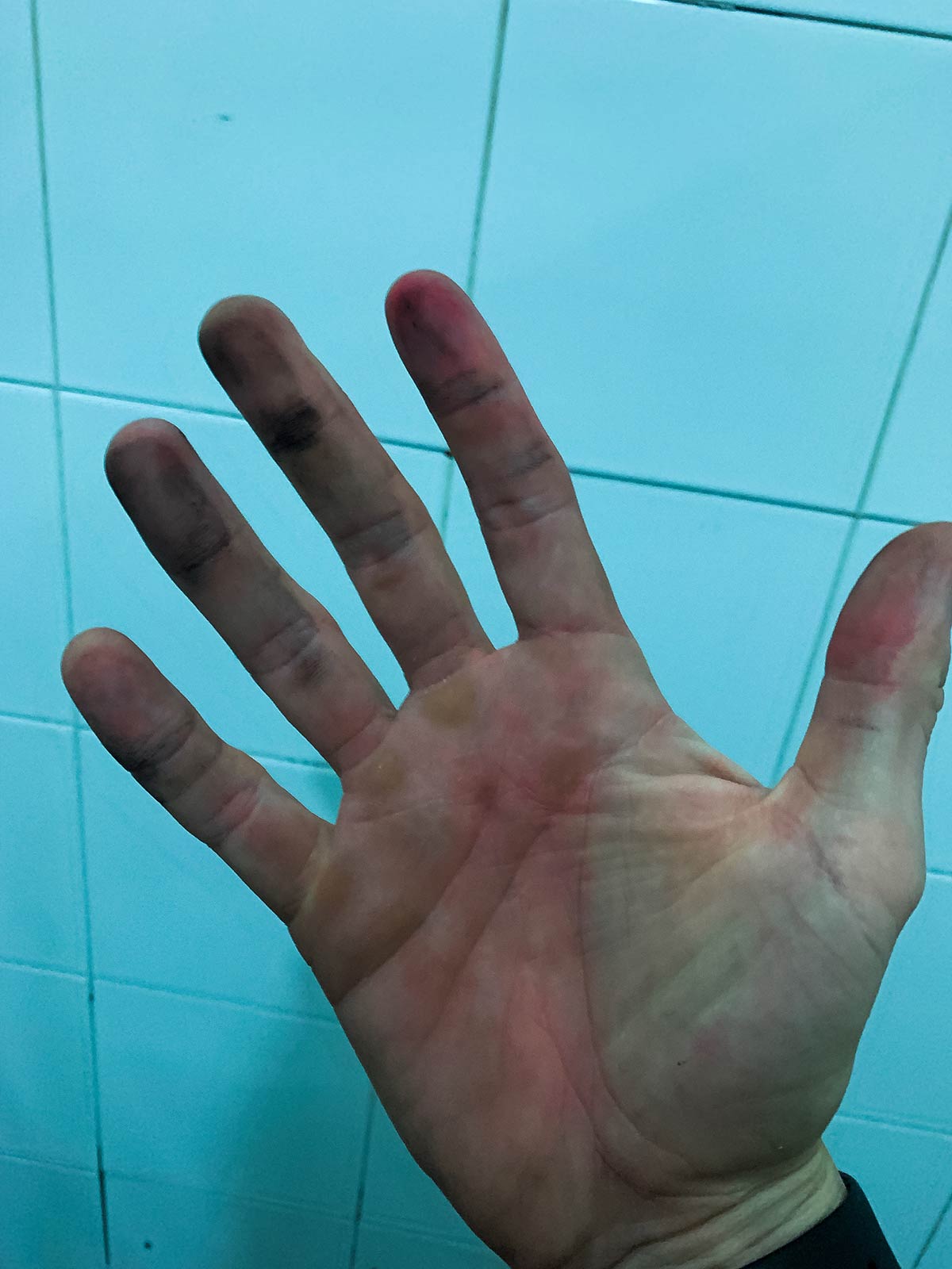 Dirty left hand after finger printing in Algiers, Algeria. 5 hours in an Algerian police station