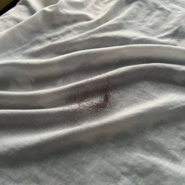 Body hairs on the bed in Jalalabad, Afghanistan. Worst food poisoning, Jalalabad
